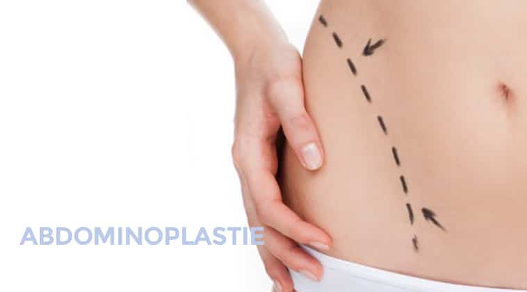 Abdominoplastie Chirurgie de la silhouette à Montpellier - Chirurgien esthétique Dr Ziade Chirurgie de la silhouette à Montpellier