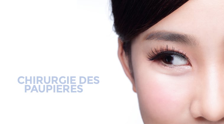 Chirurgie des paupières Chirurgie esthétique Montpellier - Dr Ziade Chirurgie du visage à Montpellier