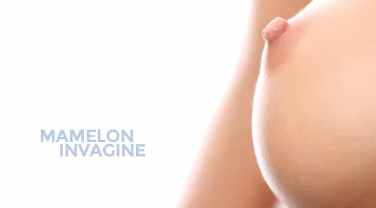 Chirurgie intime à Montpellier