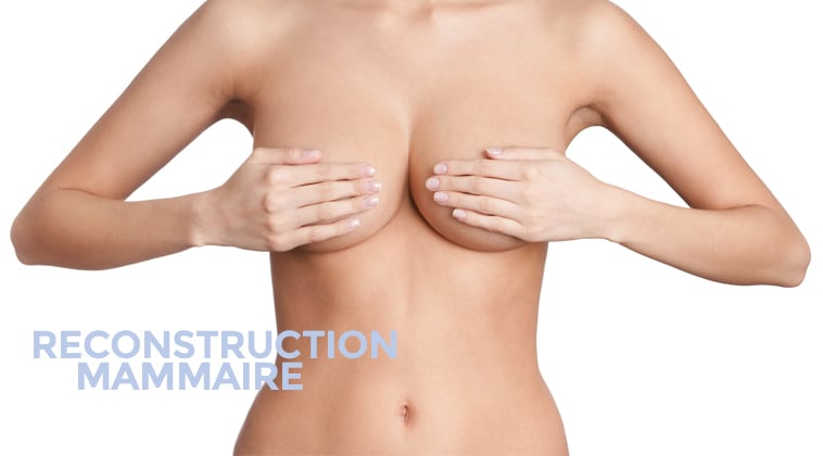 Reconstruction mammaire Chirurgie des seins à Montpellier - Dr Ziade reconstitution mammaire