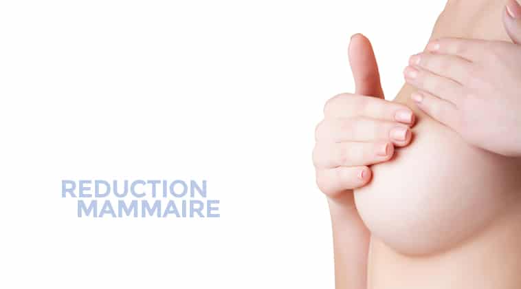 Réduction mammaire Chirurgie des seins à Montpellier - Dr Ziade Chirurgie des seins à Montpellier