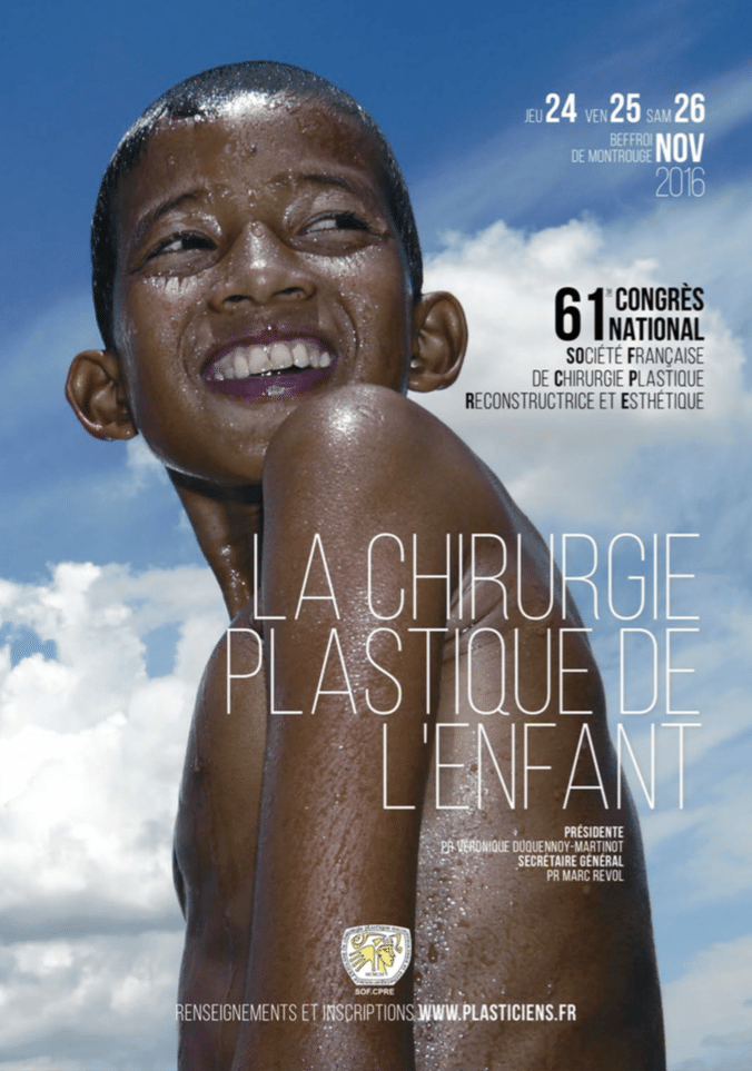 congres national chirurgie plastique