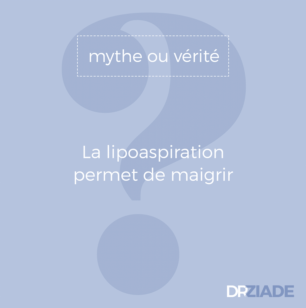 Lipoaspiration montpellier