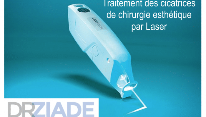 cicatrice chirurgie esthétique