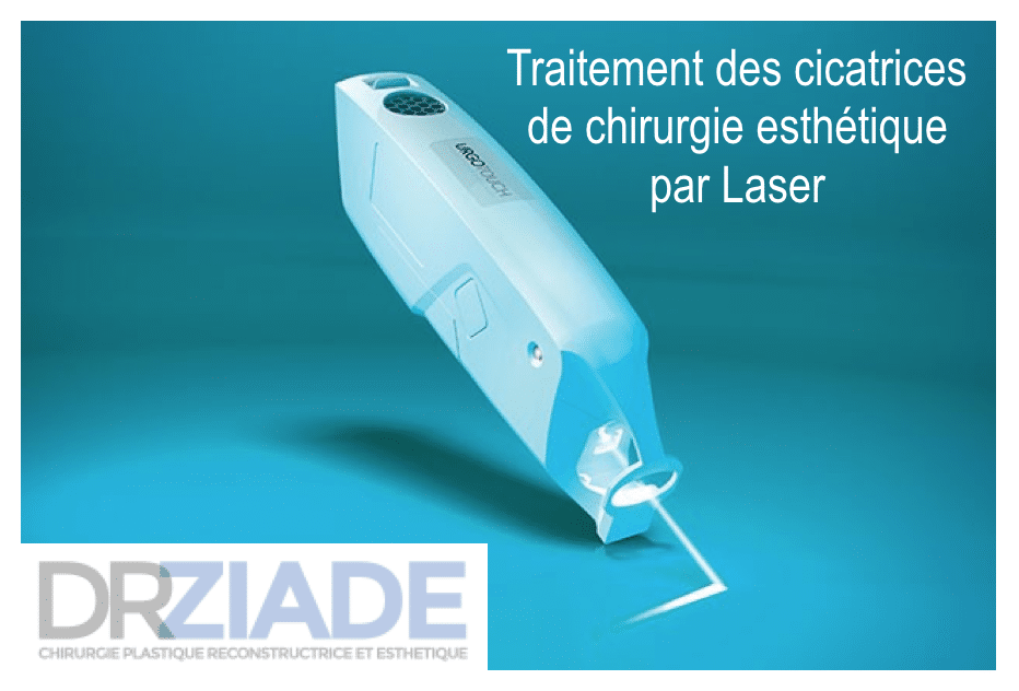 cicatrice chirurgie esthétique