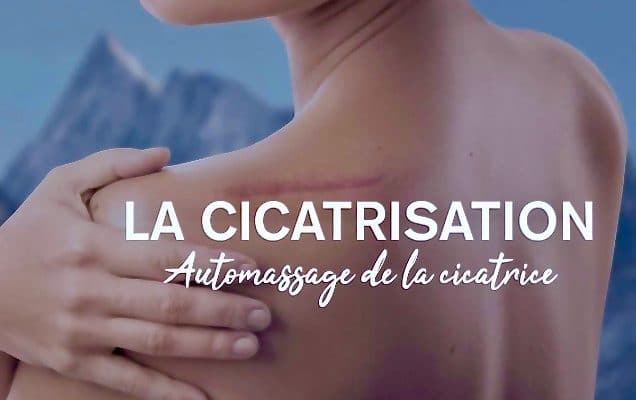 massage de cicatrice